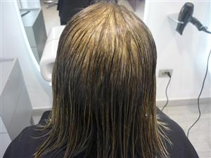 Calvizie: le condizioni dei nostri capelli