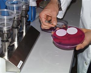Cortisolo nel capello: un indicatore di rischio cardiaco