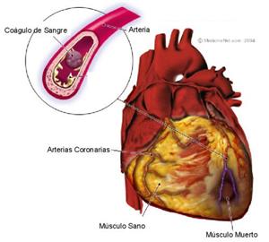 Farmaci contro gli infarti al miocardio