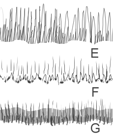 Dessiner le front et la naissance des cheveux - Image 2