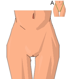 Genitali e inforcatura della donna (di fronte) - Figura 2